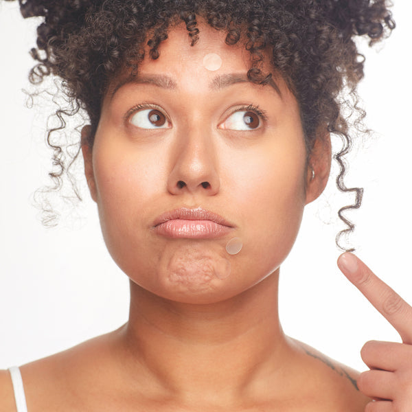 Breakout Box: 3-in-1 Acne Treatment Kit by Patchology